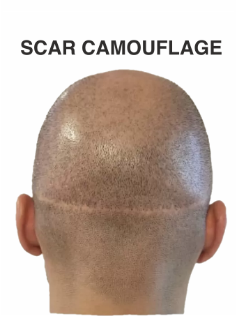 Scar Camouflage